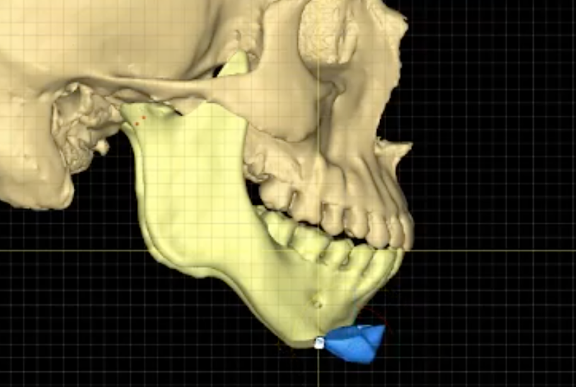 captura de pantalla 2026 03 01 a las 18.12.30