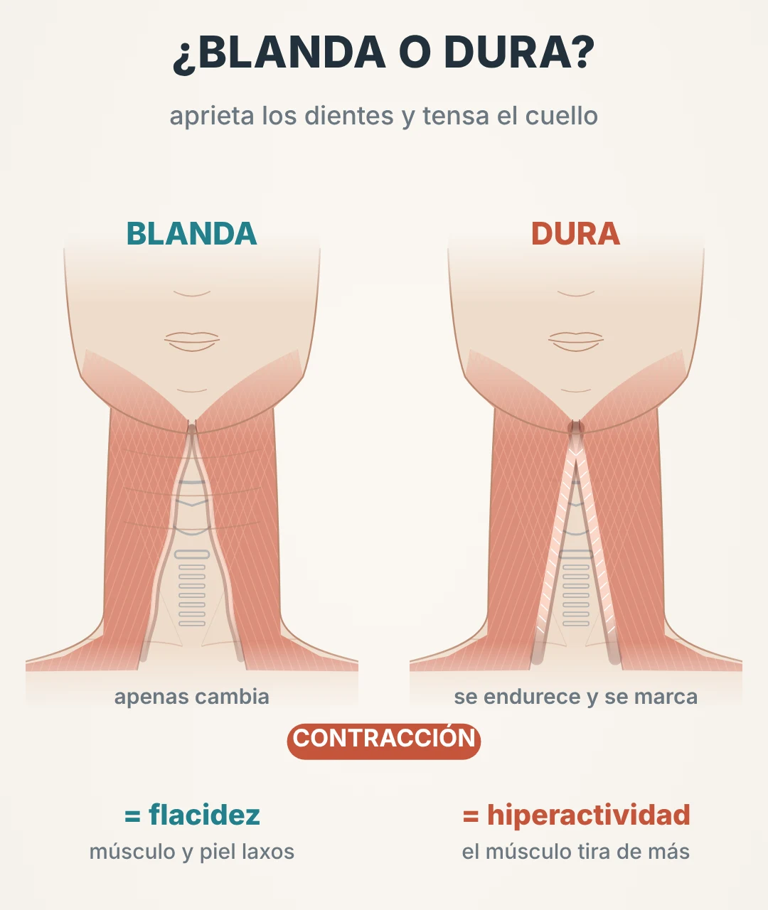 Diferencia entre bandas del platisma blandas y duras al contraer el cuello