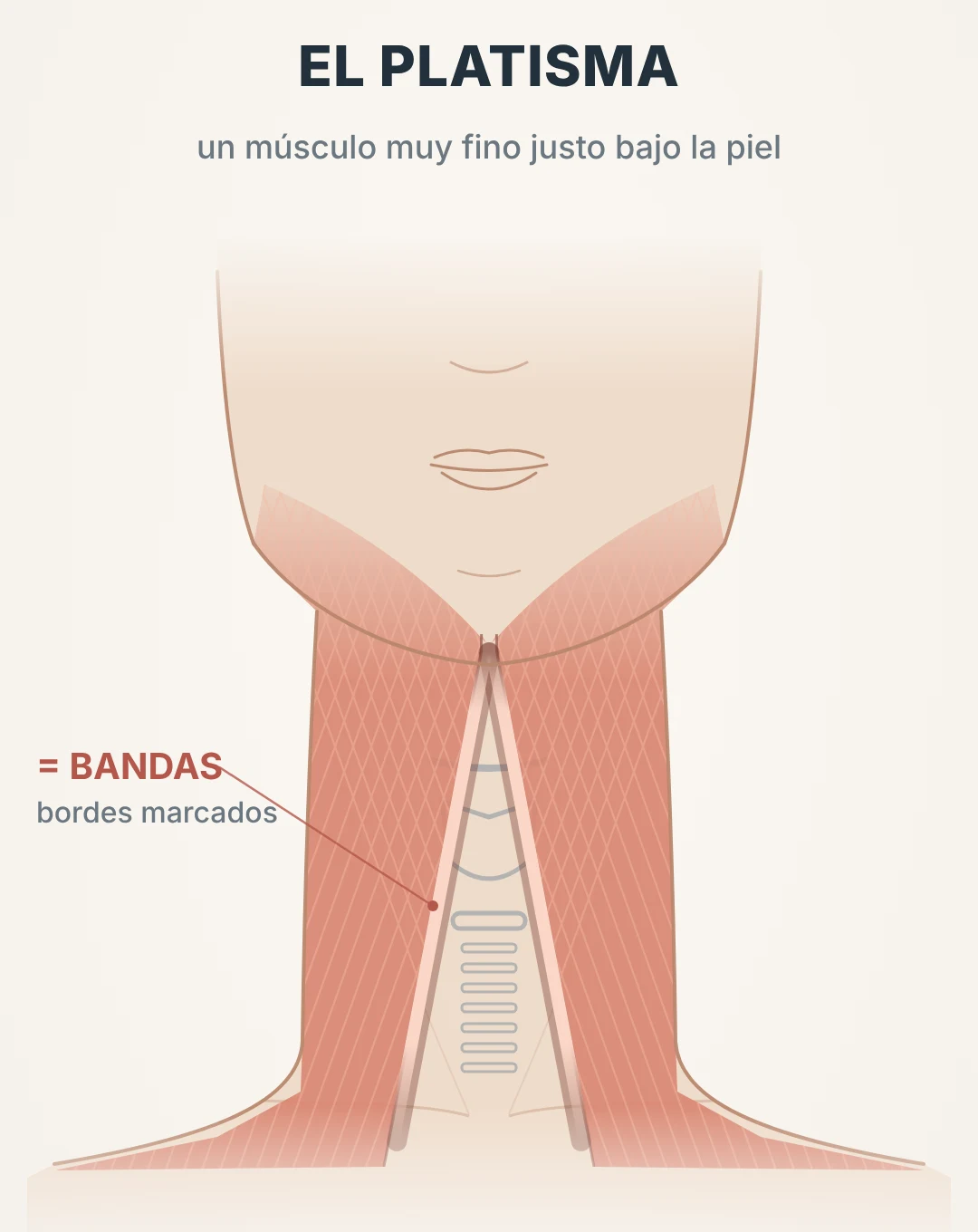 Esquema del músculo platisma y de las bandas platismales en el centro del cuello
